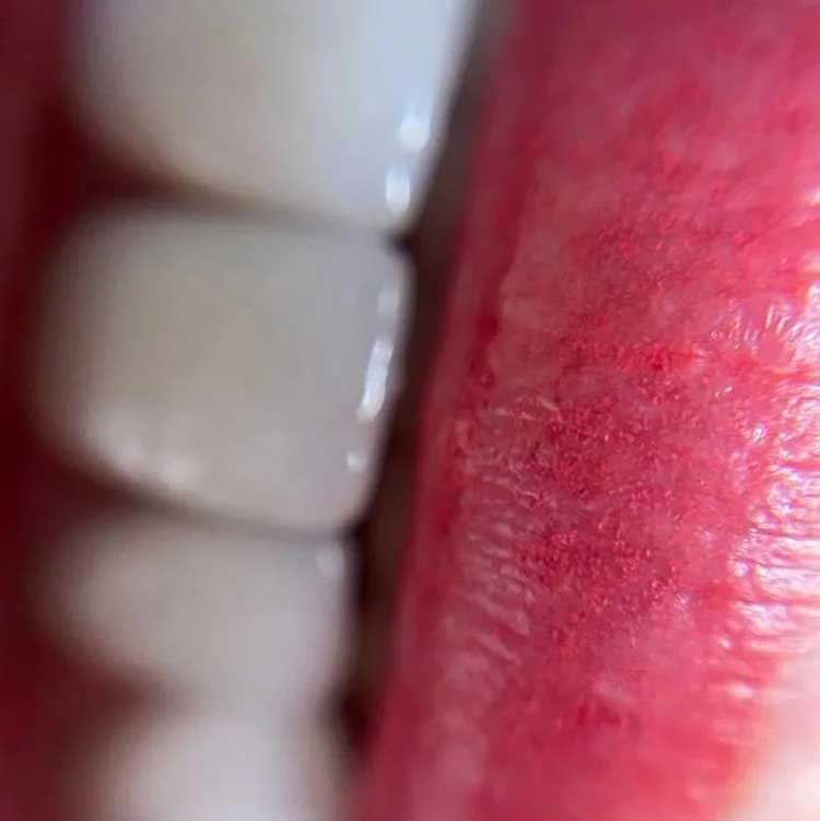 PMU-Lips-03