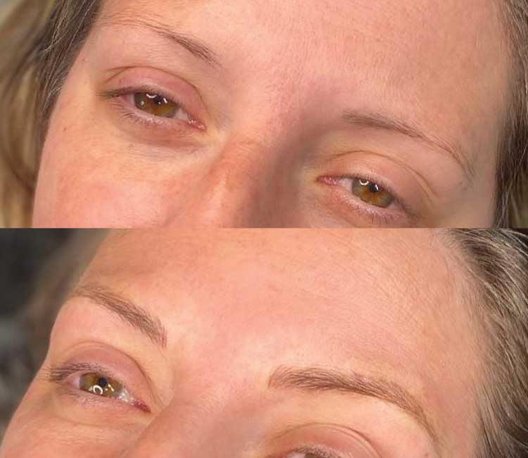 Microblading