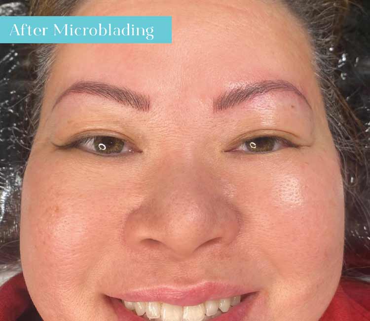 Microblading
