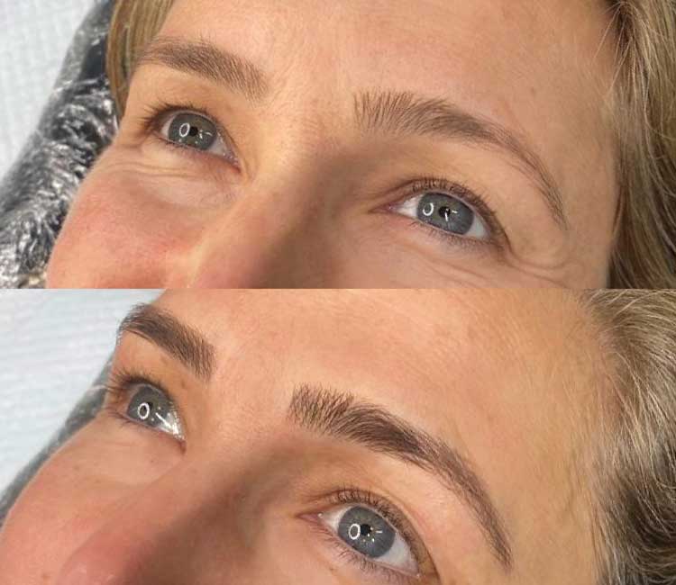 Microblading