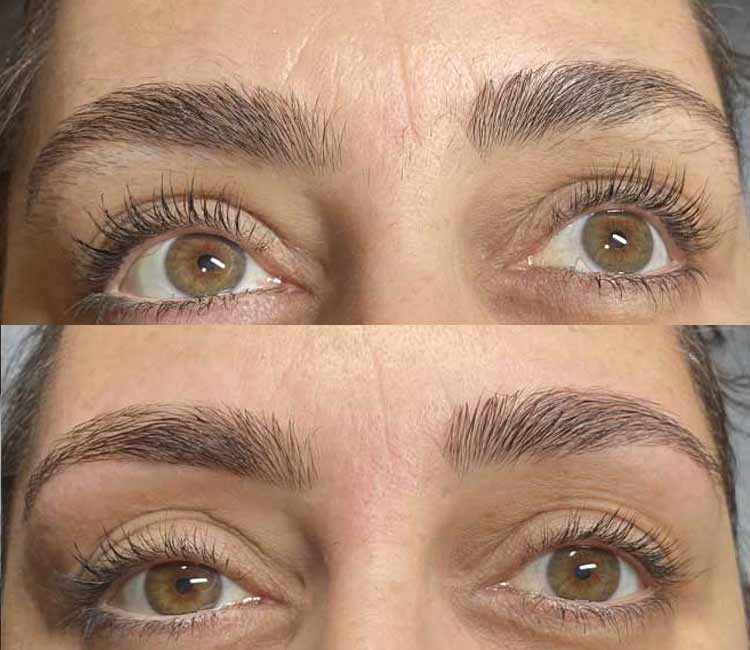 Microblading