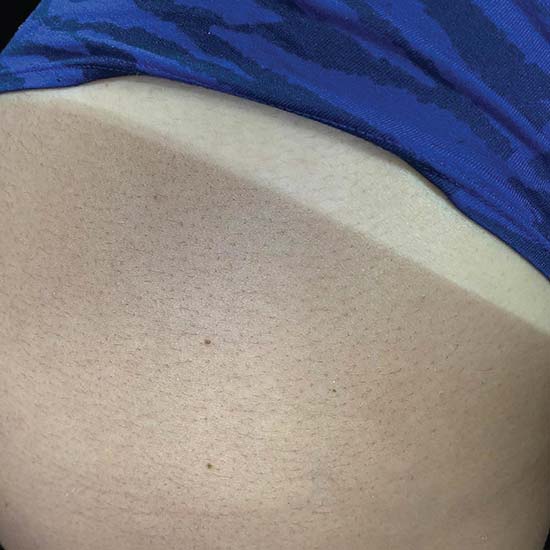 Spray Tan for females