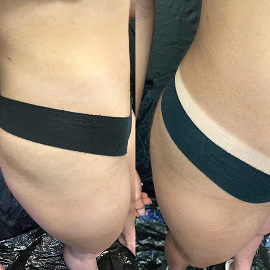 Spray-Tan-Whitby-03